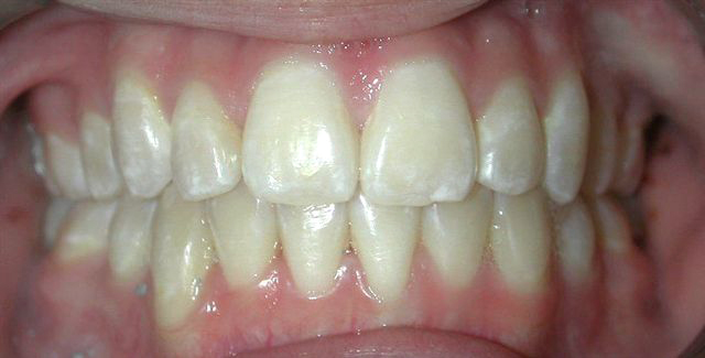 AGpO-CaseStudy-after