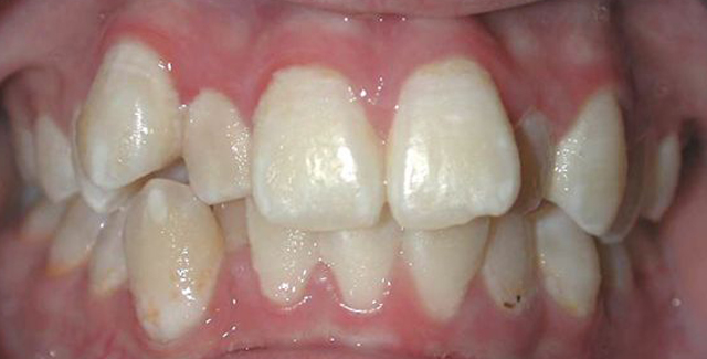 AGpO-CaseStudy-before
